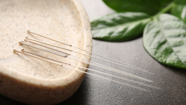 acupuncture